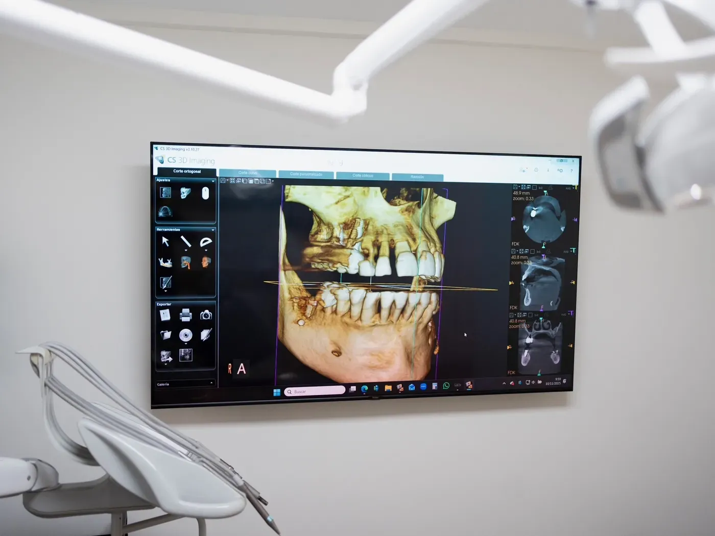 Radiografía 3D en la pantalla de un gabinete de Lisboa Dental